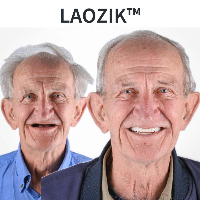 DentalKit – Apparence naturelle sans dentiste | Sourire instantané