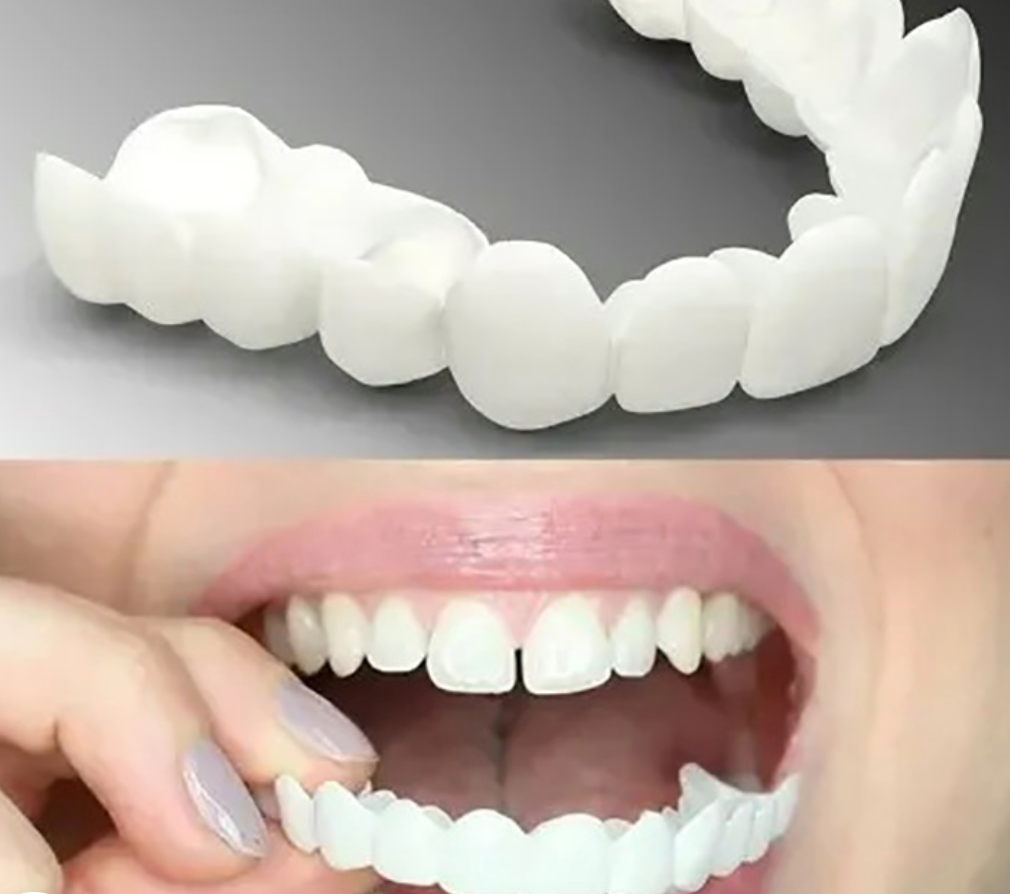 Adjustable Snap-On Dentures - Orthorun