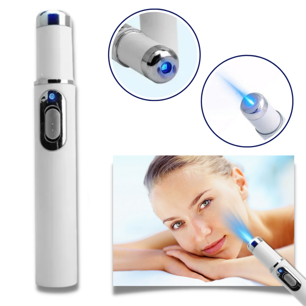Cromos | Thérapie Laser Portable pour une Peau Éclatante – DermaPure