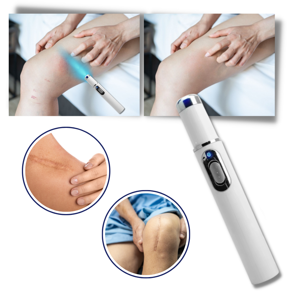 Cromos | Thérapie Laser Portable pour une Peau Éclatante – DermaPure
