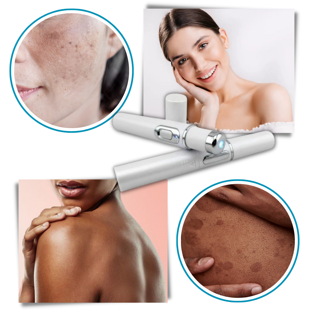 Cromos | Thérapie Laser Portable pour une Peau Éclatante – DermaPure