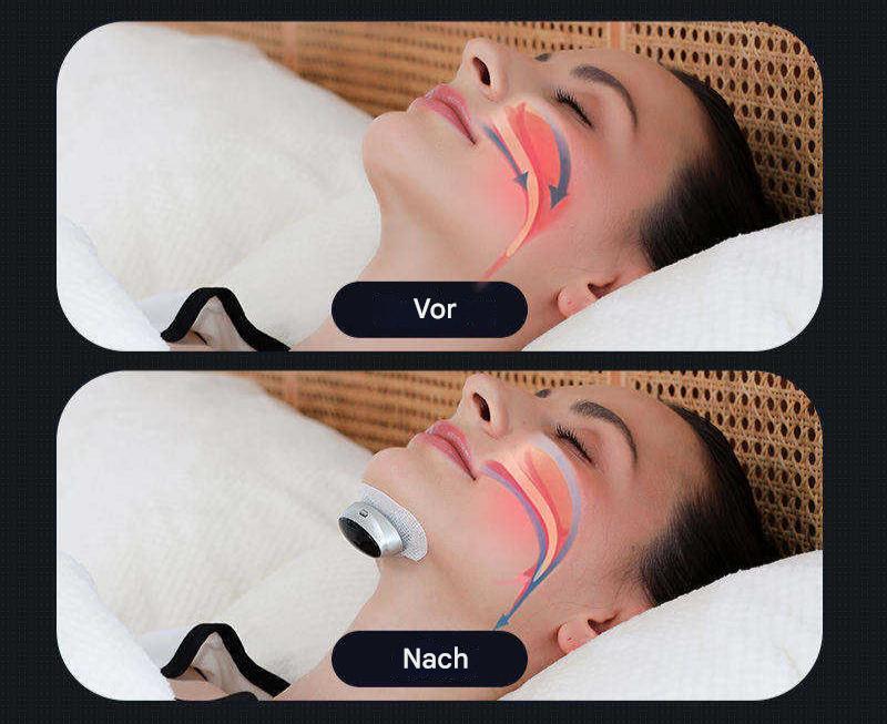 Cromos | Appareil Apnée du Sommeil Compact – AirEase