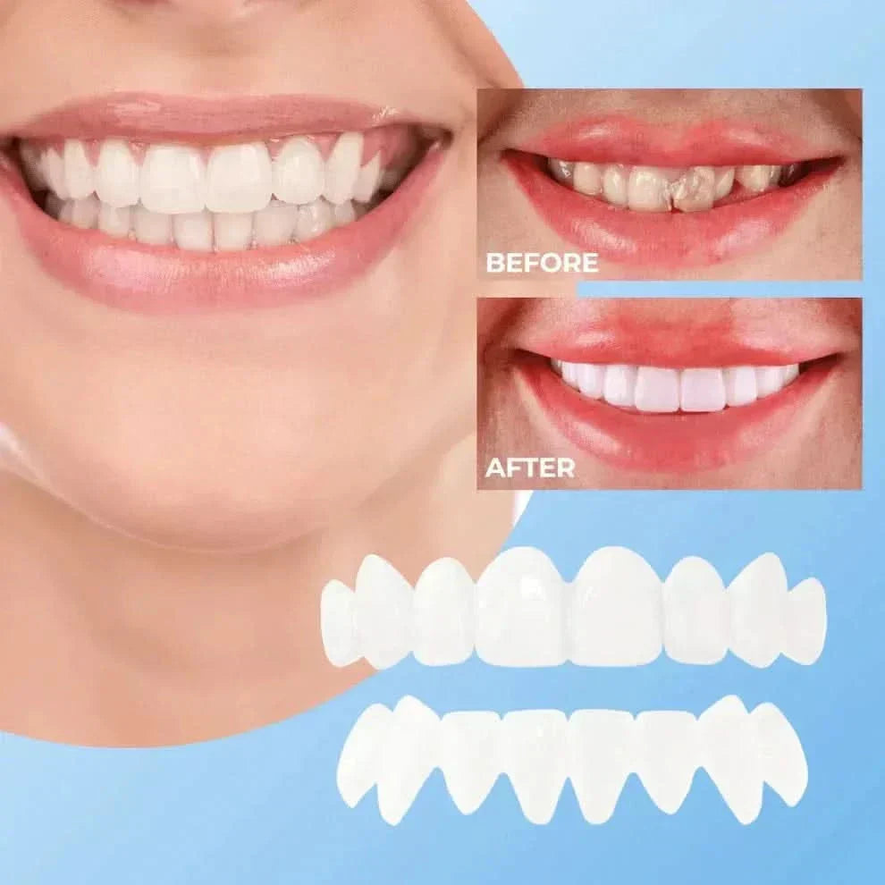 Facettes Dentaires Effet Blanc Naturel – Cromos