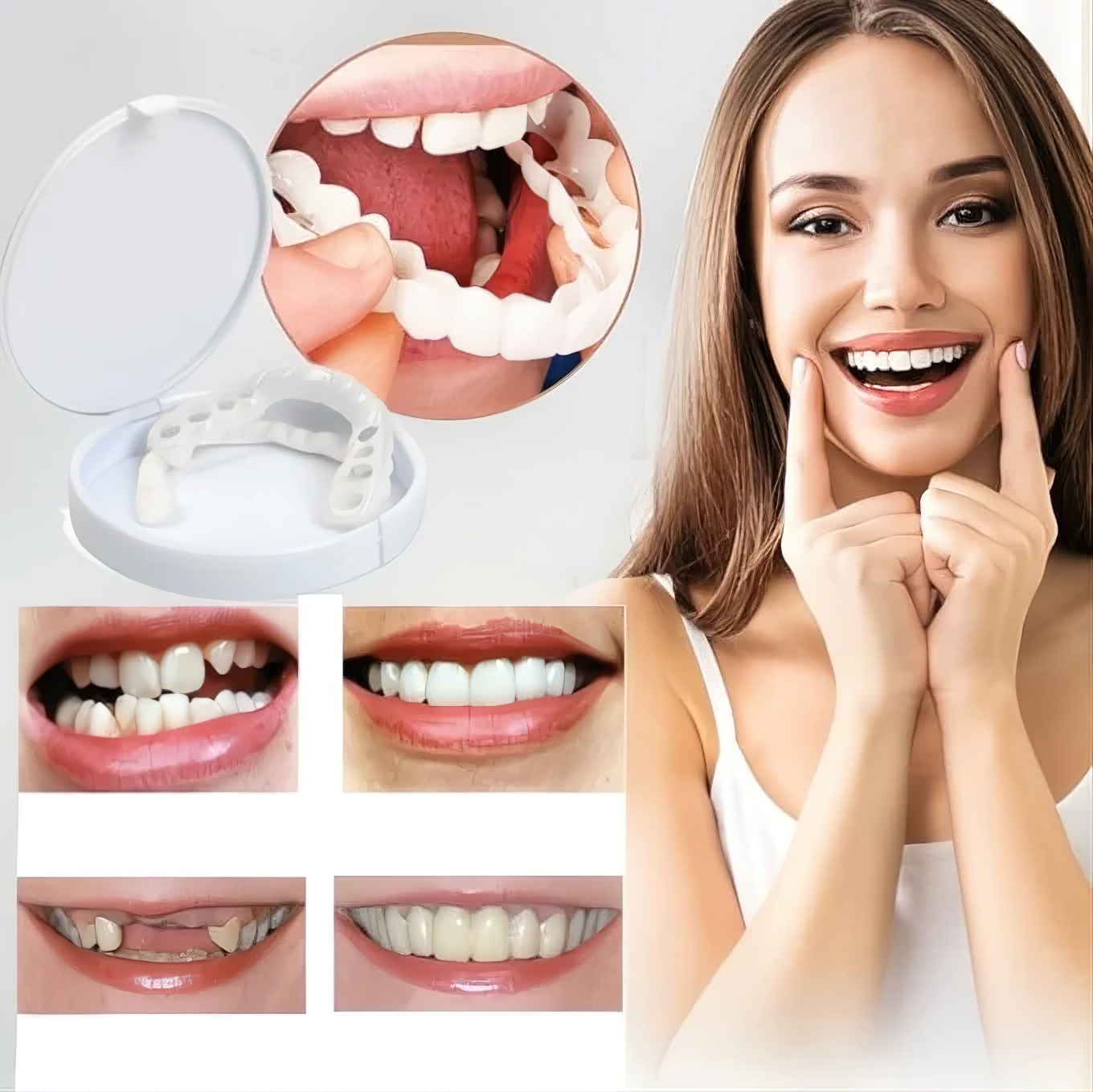 Facettes Dentaires Effet Blanc Naturel – Cromos